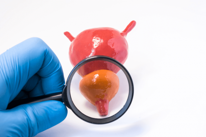 Prostat Enfeksiyonu (Prostatit) Nedir? Prostat Enfeksiyonu (Prostatit) Nedir?