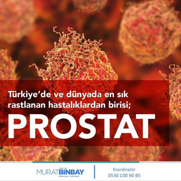 Prostat Belirtileri Nelerdir ? Prostat Belirtileri Nelerdir ?
