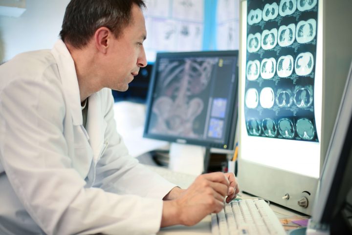 Lutesyum PSMA tedavisi nedir? Lutesyum PSMA tedavisi nedir?
