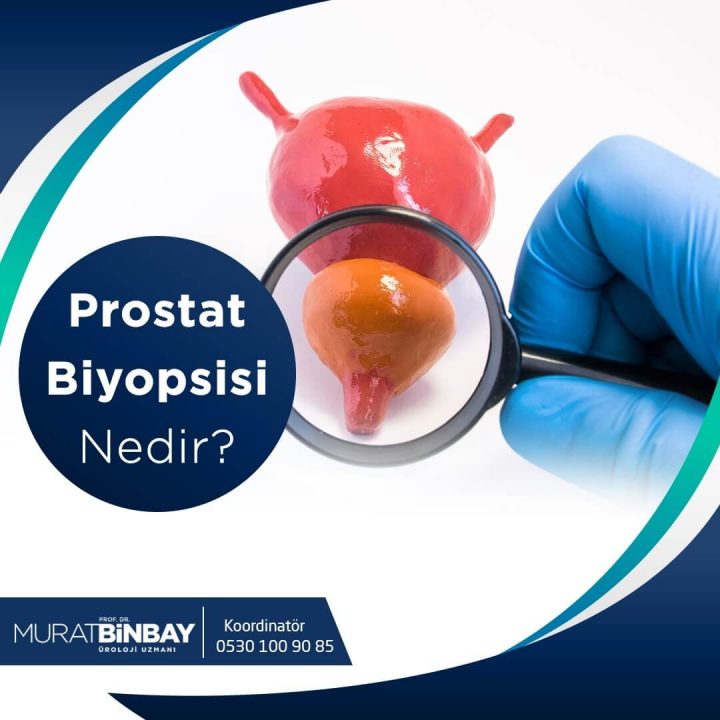 Prostat Biyopsisi