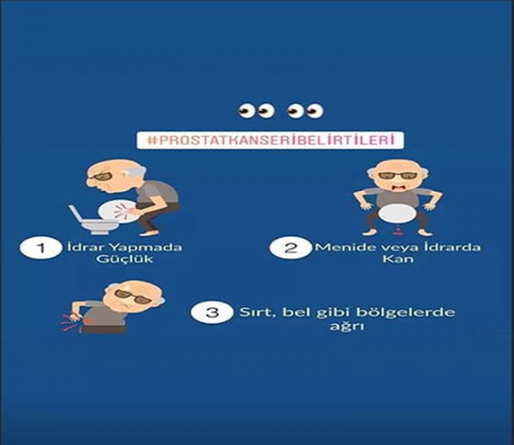Prostat Kanseri Belirtileri Nelerdir? Prostat Kanseri Belirtileri Nelerdir?