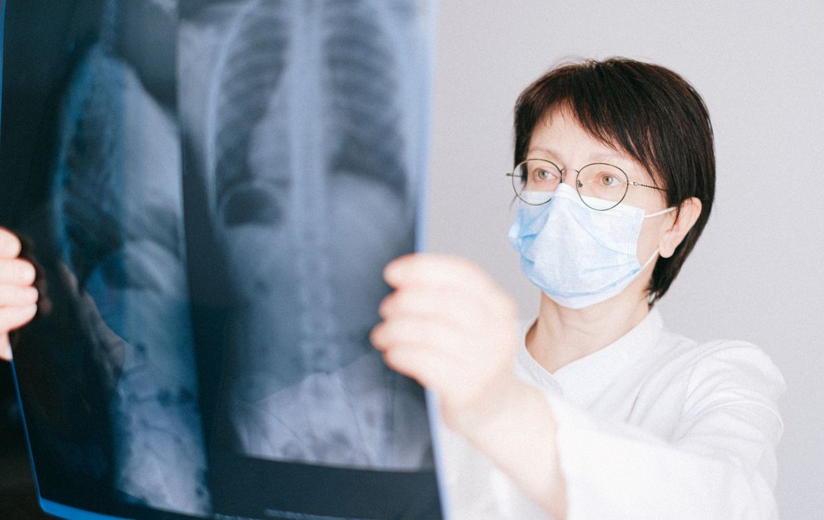 Prostat Ameliyatı - Salvage Prostatektomi: Radyoterapi Sonrası Nüks Eden Prostat Kanserinde Kurtarma Cerrahisi