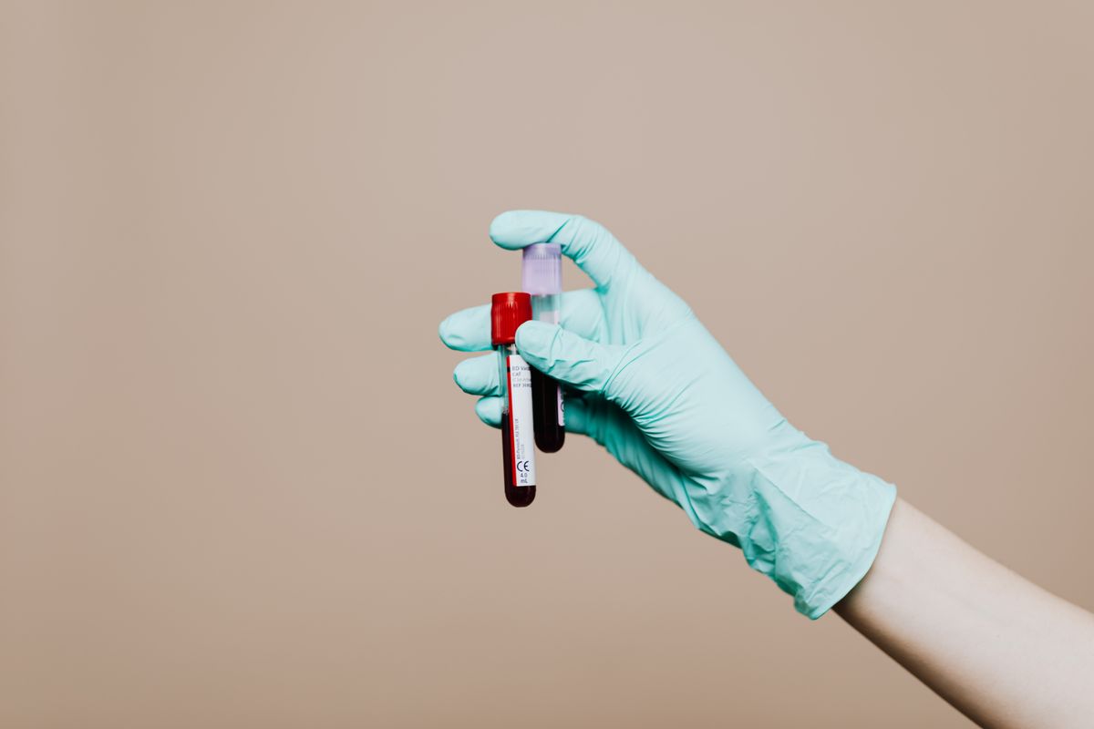 Prostat ameliyatı öncesi hazırlık için alınan kan tahlili tüpü